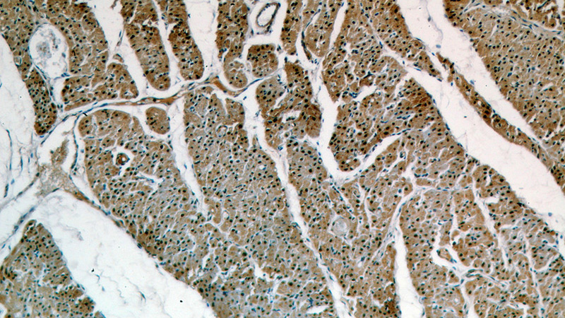 Immunohistochemical of paraffin-embedded human heart using Catalog No:111888(JMJD6 antibody) at dilution of 1:50 (under 10x lens)