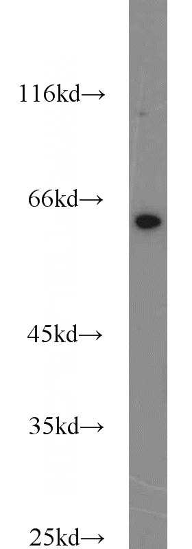 PC-13 cells were subjected to SDS PAGE followed by western blot with Catalog No:115398(SMOX antibody) at dilution of 1:500