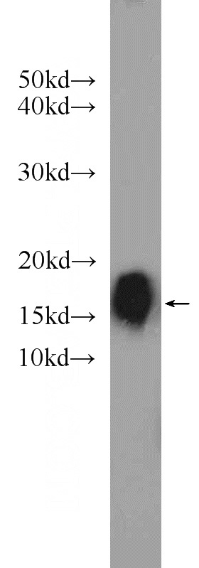 HEK-293 cells were subjected to SDS PAGE followed by western blot with Catalog No:108677(C1orf31 antibody) at dilution of 1:1000