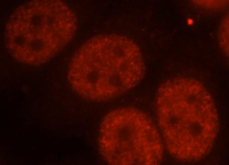 Immunofluorescent analysis of MCF-7 cells, using FIP1L1 antibody Catalog No:110666 at 1:25 dilution and Rhodamine-labeled goat anti-rabbit IgG (red).