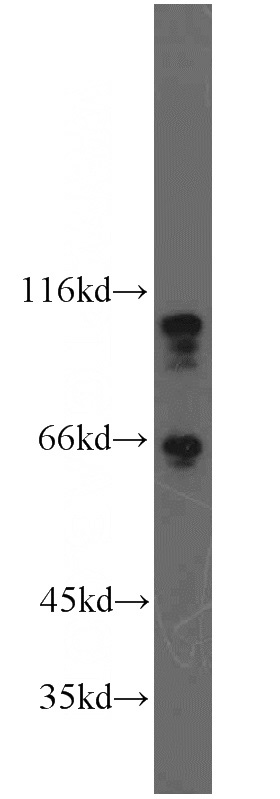 RAW264.7 cells were subjected to SDS PAGE followed by western blot with Catalog No:113533(CTNND1 antibody) at dilution of 1:500