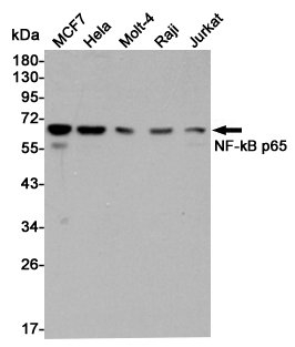 Western blot analysis of NF-kB p65 expression in MCF7,Hela,Molt-4,Raji and Jurkat cell lysates using NF-kB p65 antibody at 1/5000 dilution.Predicted band size:65KDa.Observed band size:65KDa.