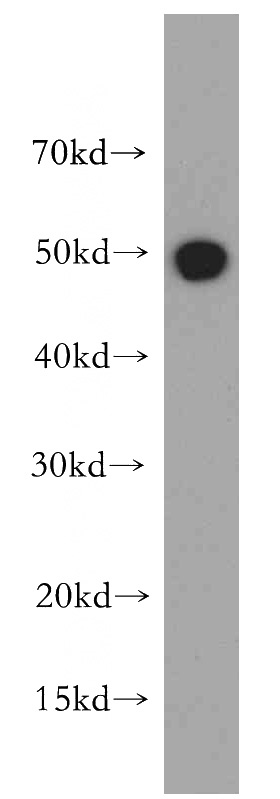 Jurkat cells were subjected to SDS PAGE followed by western blot with Catalog No:114589(RBBP4 antibody) at dilution of 1:500