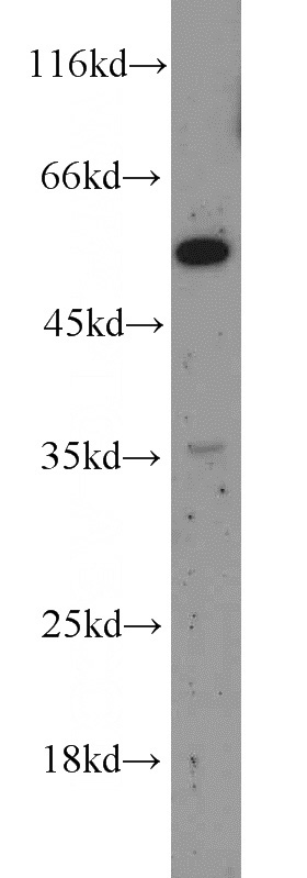 HepG2 cells were subjected to SDS PAGE followed by western blot with Catalog No:108054(AGT antibody) at dilution of 1:600