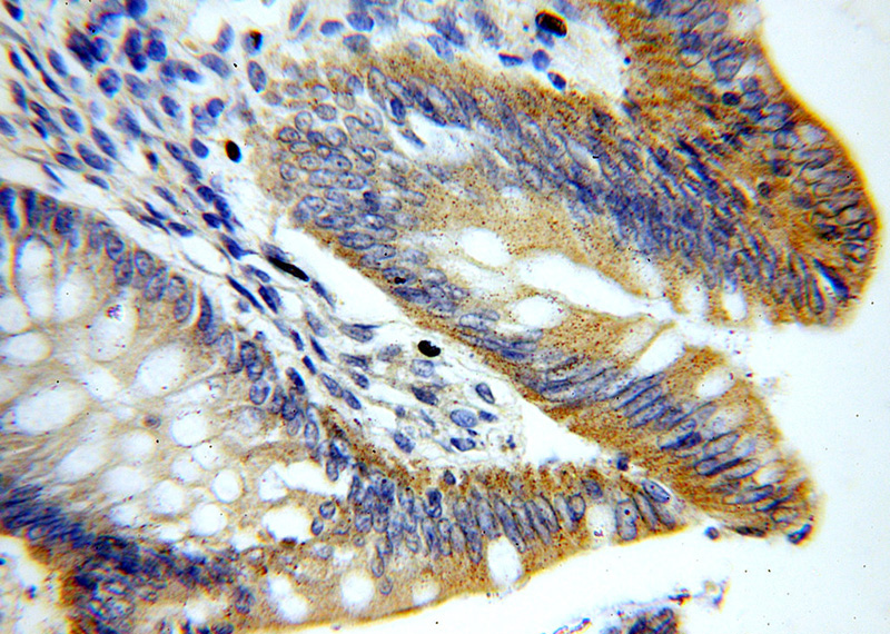 Immunohistochemical of paraffin-embedded human colon using Catalog No:116884(YES1-Specific antibody) at dilution of 1:50 (under 40x lens)