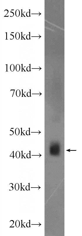 mouse heart tissue were subjected to SDS PAGE followed by western blot with Catalog No:107715(ACTR1B Antibody) at dilution of 1:600