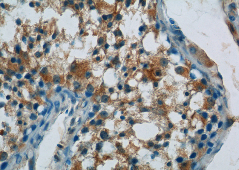Immunohistochemistry of paraffin-embedded human testis tissue slide using Catalog No:108239(ARCN1 Antibody) at dilution of 1:50 (under 40x lens)