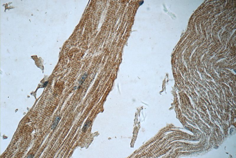 Immunohistochemistry of paraffin-embedded human skeletal muscle tissue slide using Catalog No:115779(SYNC Antibody) at dilution of 1:50 (under 40x lens)