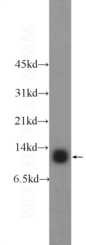 HeLa cells were subjected to SDS PAGE followed by western blot with Catalog No:109099(CDC26 Antibody) at dilution of 1:300