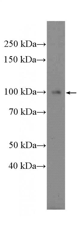 SKOV-3 cells were subjected to SDS PAGE followed by western blot with Catalog No:113664(PDE5A Antibody) at dilution of 1:300