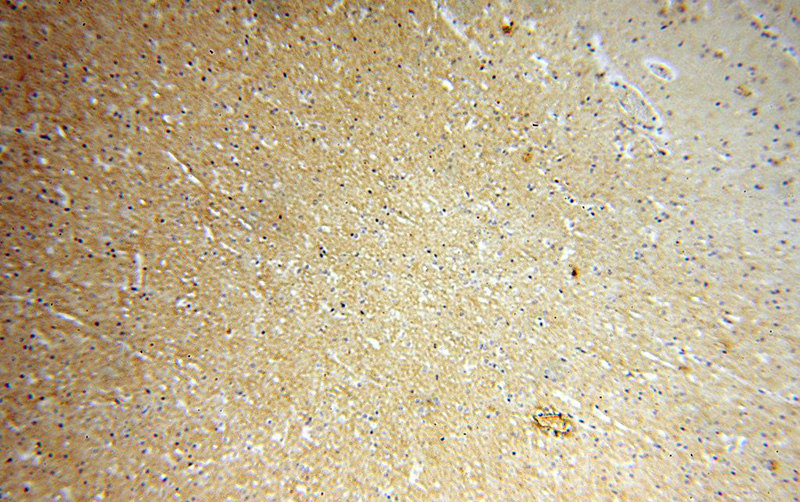 Immunohistochemical of paraffin-embedded human brain using Catalog No:112262(L2HGDH antibody) at dilution of 1:100 (under 10x lens)