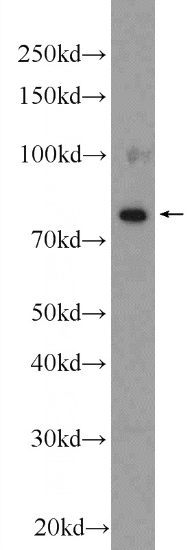 mouse lung tissue were subjected to SDS PAGE followed by western blot with Catalog No:110478(ESRP2 Antibody) at dilution of 1:1500