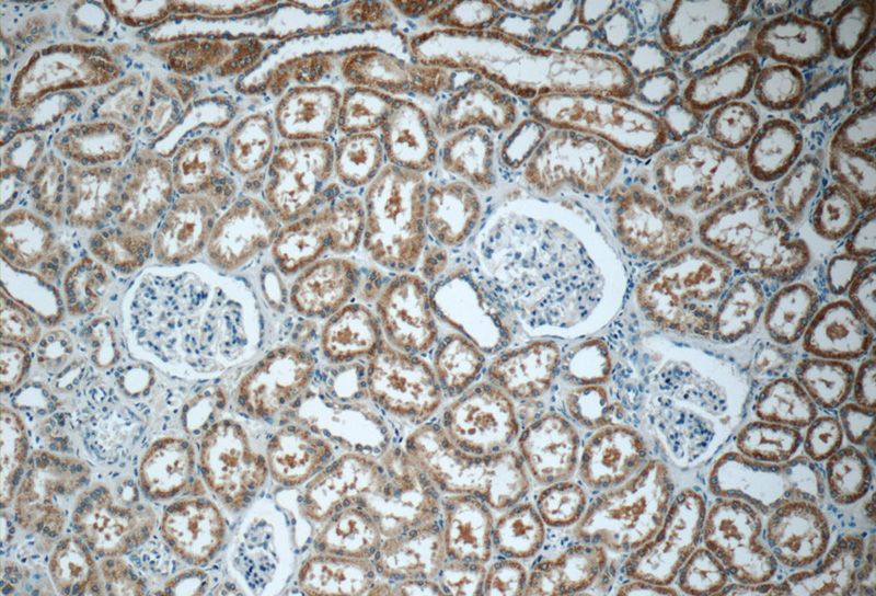Immunohistochemistry of paraffin-embedded human kidney tissue slide using Catalog No:114137(PPM1L Antibody) at dilution of 1:50 (under 10x lens)