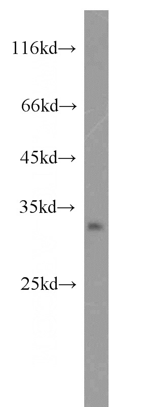 HeLa cells were subjected to SDS PAGE followed by western blot with Catalog No:109960(DNASE2 antibody) at dilution of 1:300