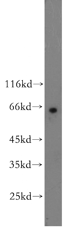 SH-SY5Y cells were subjected to SDS PAGE followed by western blot with Catalog No:109112(CDC7 antibody) at dilution of 1:500