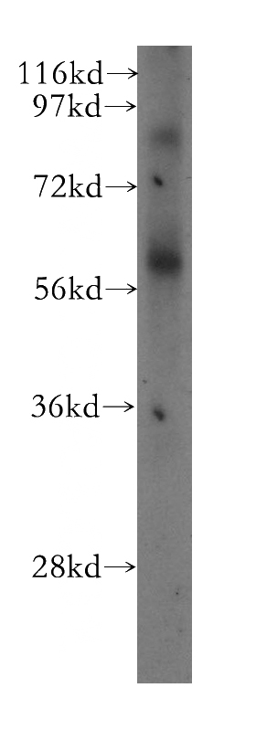 human lung tissue were subjected to SDS PAGE followed by western blot with Catalog No:115551(SPATA2 antibody) at dilution of 1:800