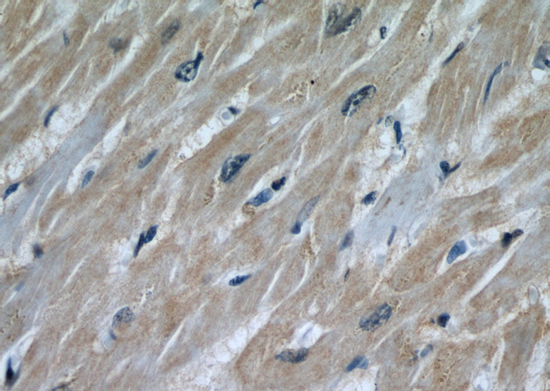 Immunohistochemical of paraffin-embedded human heart using Catalog No:115807(STUB1 antibody) at dilution of 1:50 (under 40x lens)
