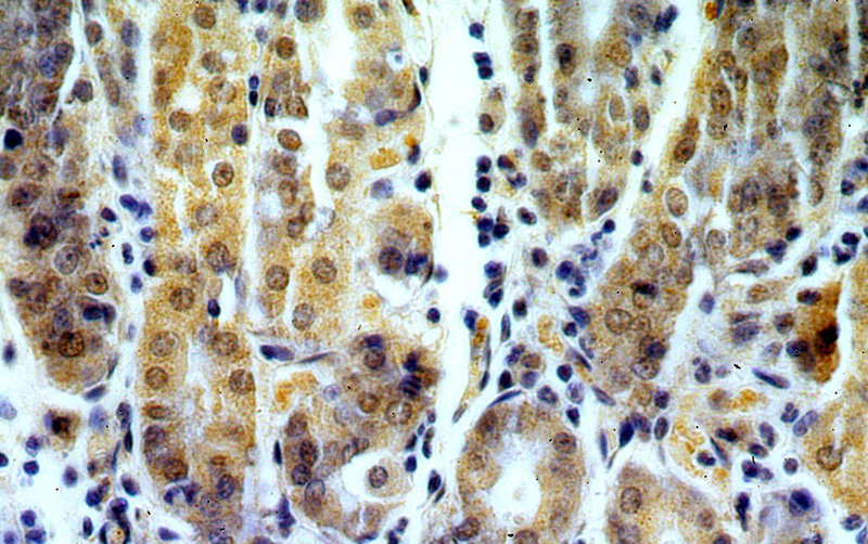 Immunohistochemical of paraffin-embedded human stomach using Catalog No:114476(RASGEF1B antibody) at dilution of 1:50 (under 40x lens)