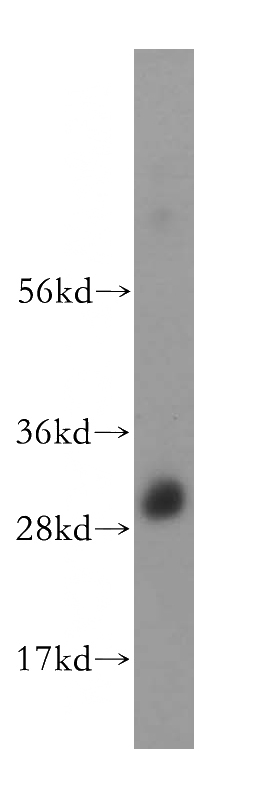 human brain tissue were subjected to SDS PAGE followed by western blot with Catalog No:113522(OVOL1 antibody) at dilution of 1:400
