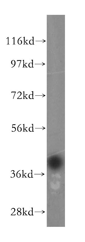 human testis tissue were subjected to SDS PAGE followed by western blot with Catalog No:114239(PRPSAP1 antibody) at dilution of 1:800