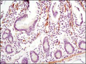 Immunohistochemical analysis of paraffin-embedded human small intestine using LPP mouse mAb with DAB staining.