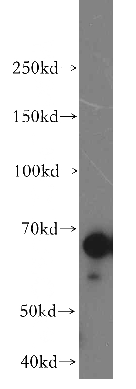 Jurkat cells were subjected to SDS PAGE followed by western blot with Catalog No:113460(OAS2 antibody) at dilution of 1:500