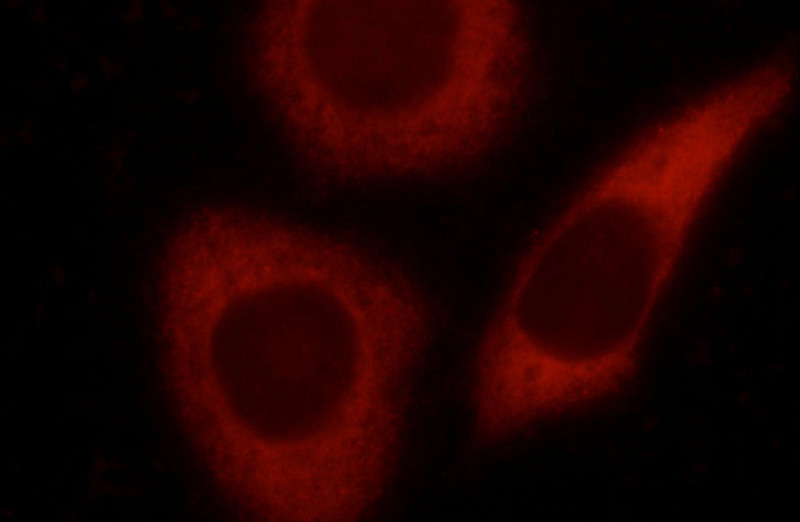 Immunofluorescent analysis of HeLa cells using Catalog No:112178(LCTL Antibody) at dilution of 1:25 and Rhodamine-Goat anti-Rabbit IgG