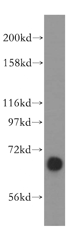 mouse kidney tissue were subjected to SDS PAGE followed by western blot with Catalog No:108305(ATP6V1A antibody) at dilution of 1:500