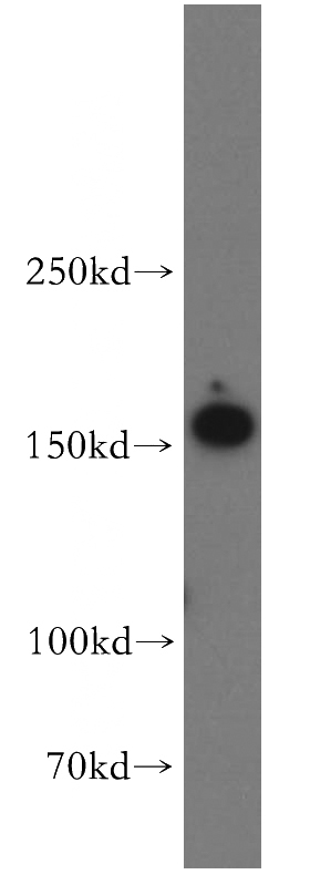 HEK-293 cells were subjected to SDS PAGE followed by western blot with Catalog No:114805(RPGRIP1L antibody) at dilution of 1:800