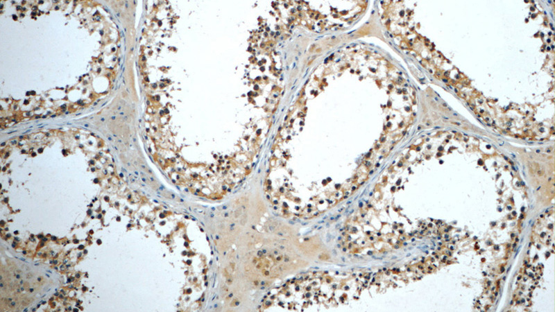 Immunohistochemistry of paraffin-embedded human testis tissue slide using Catalog No:111663(IFT122 Antibody) at dilution of 1:50 (under 10x lens)