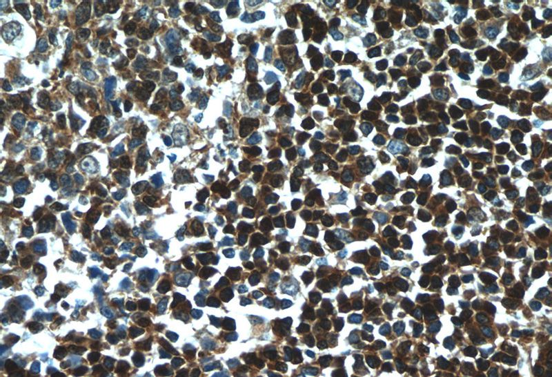 Immunohistochemistry of paraffin-embedded human tonsillitis tissue slide using Catalog No:115911(TCL1A Antibody) at dilution of 1:50 (under 40x lens)