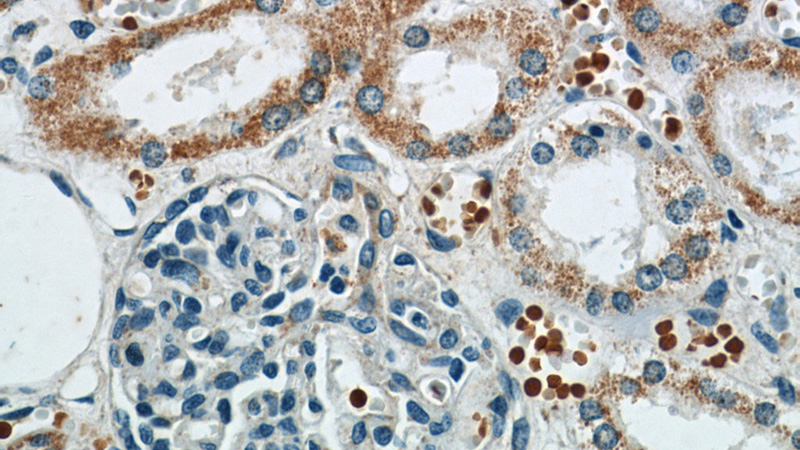 Immunohistochemistry of paraffin-embedded human kidney slide using Catalog No:108295(ATG3 Antibody) at dilution of 1:50