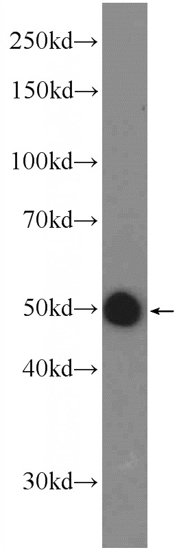 mouse brain tissue were subjected to SDS PAGE followed by western blot with Catalog No:115084(SEC61A2 Antibody) at dilution of 1:600