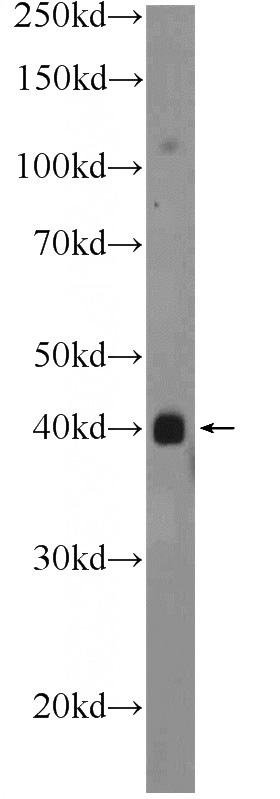 A375 cells were subjected to SDS PAGE followed by western blot with Catalog No:113801(PHC2 Antibody) at dilution of 1:600