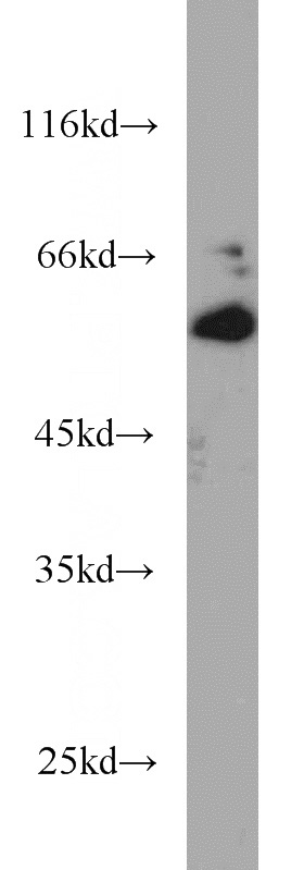 Jurkat cells were subjected to SDS PAGE followed by western blot with Catalog No:111590(ICAM2 antibody) at dilution of 1:500
