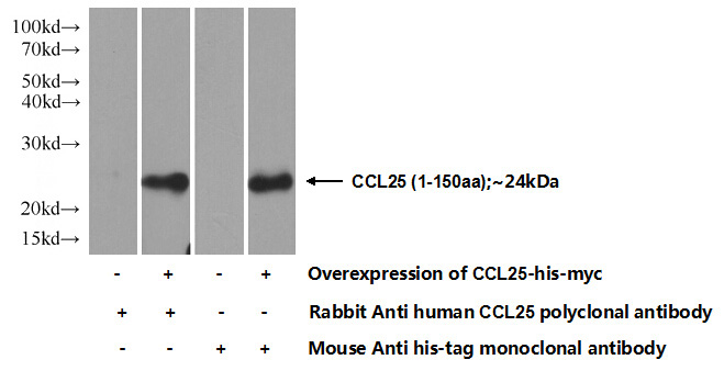 Transfected HEK-293 cells were subjected to SDS PAGE followed by western blot with Catalog No:109002(CCL25 Antibody) at dilution of 1:700