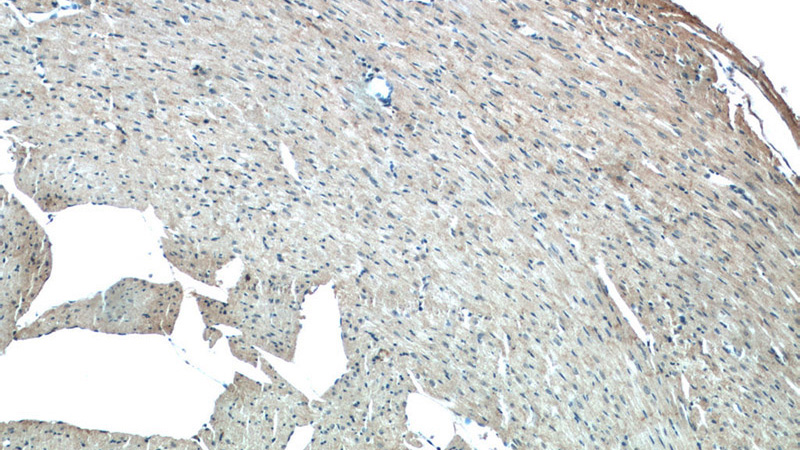 Immunohistochemistry of paraffin-embedded mouse heart tissue slide using Catalog No:109899(DSP Antibody) at dilution of 1:50 (under 10x lens)