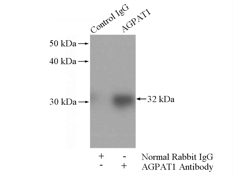 IP Result of anti-AGPAT1 (IP:Catalog No:107831, 4ug; Detection:Catalog No:107831 1:300) with Raji cells lysate 2000ug.