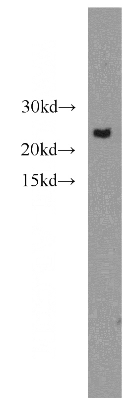 HepG2 cells were subjected to SDS PAGE followed by western blot with Catalog No:112767(COX2 antibody) at dilution of 1:1000