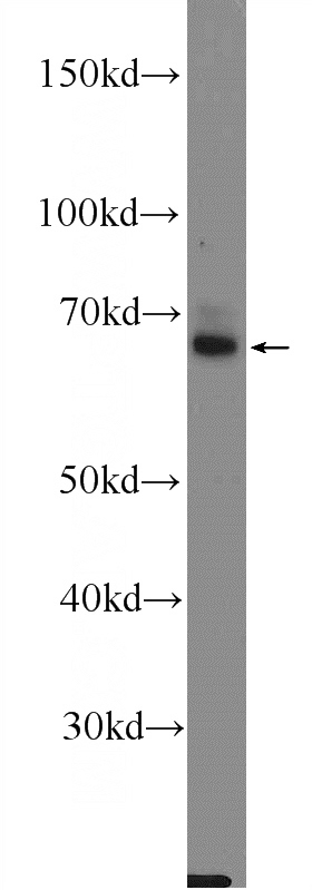 rat brain tissue were subjected to SDS PAGE followed by western blot with Catalog No:109869(SLC6A3 Antibody) at dilution of 1:600