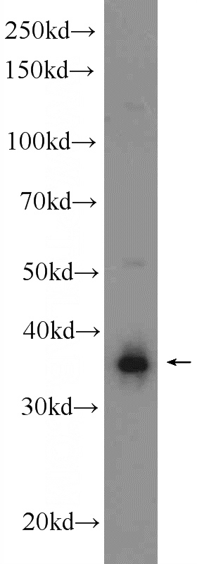 C6 cells were subjected to SDS PAGE followed by western blot with Catalog No:115731(STOML2 Antibody) at dilution of 1:1000