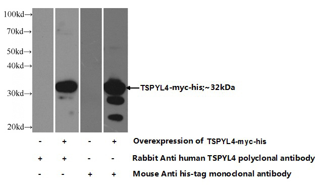 Transfected HEK-293 cells were subjected to SDS PAGE followed by western blot with Catalog No:116369(TSPYL4 Antibody) at dilution of 1:1000