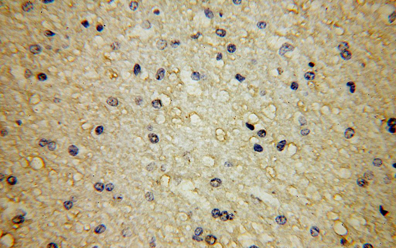 Immunohistochemical of paraffin-embedded human brain using Catalog No:108021(APLP2 antibody) at dilution of 1:50 (under 40x lens)
