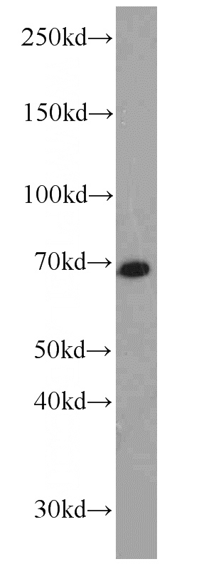mouse brain tissue were subjected to SDS PAGE followed by western blot with Catalog No:113294(NOL4 antibody) at dilution of 1:800