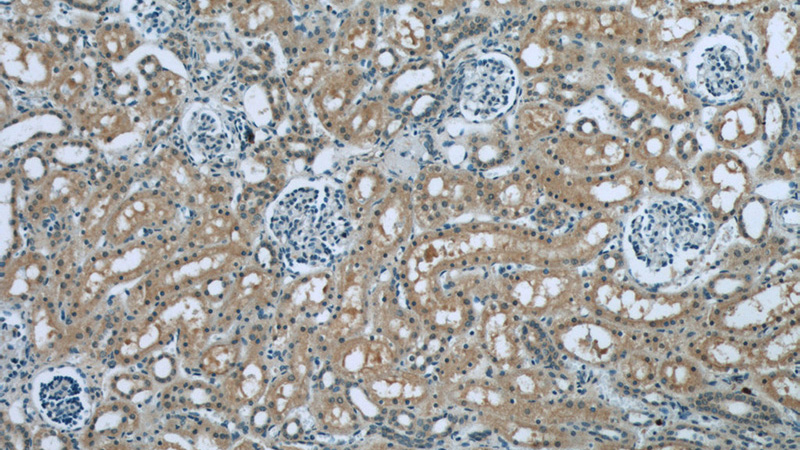 Immunohistochemistry of paraffin-embedded human kidney tissue slide using Catalog No:114845(RPS6KA3 Antibody) at dilution of 1:50(under 10x lens)