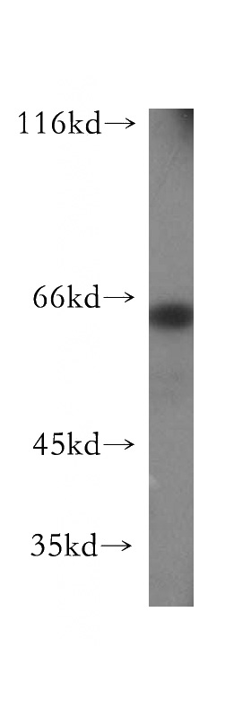 HepG2 cells were subjected to SDS PAGE followed by western blot with Catalog No:111198(GRB10 antibody) at dilution of 1:500