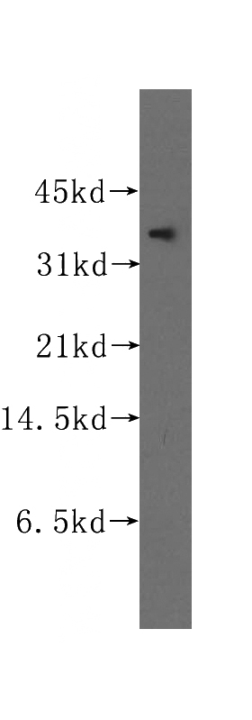 K-562 cells were subjected to SDS PAGE followed by western blot with Catalog No:116653(UBLCP1 antibody) at dilution of 1:500