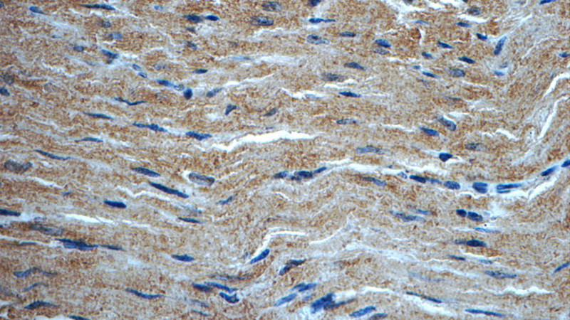 Immunohistochemistry of paraffin-embedded mouse heart tissue slide using Catalog No:112936(MYH7 Antibody) at dilution of 1:50 (under 40x lens)