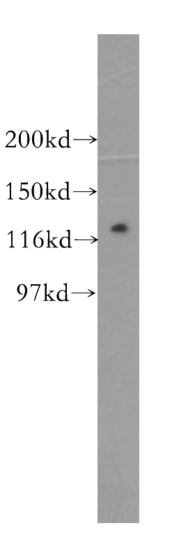 mouse skeletal muscle tissue were subjected to SDS PAGE followed by western blot with Catalog No:114148(PPP1R12B antibody) at dilution of 1:500