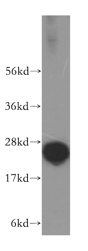 human brain tissue were subjected to SDS PAGE followed by western blot with Catalog No:114386(PSMB6 antibody) at dilution of 1:500